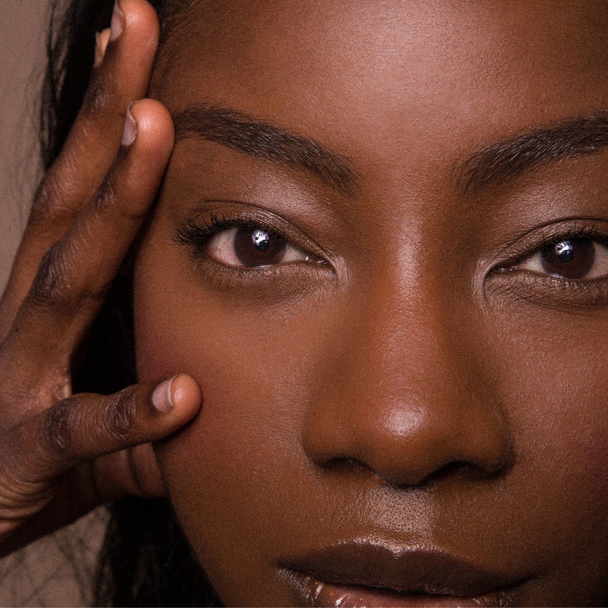 Why Hyperpigmentation is Harder to Treat on Dark Skin, And What Actually Works