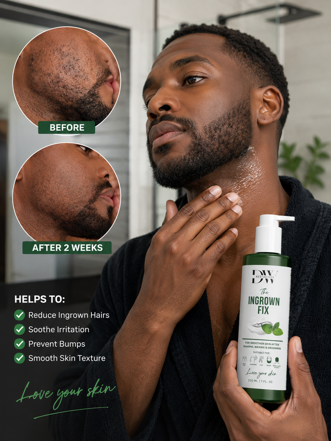 Why Do Ingrown Hairs Happen? Causes, Prevention and Treatment Guide