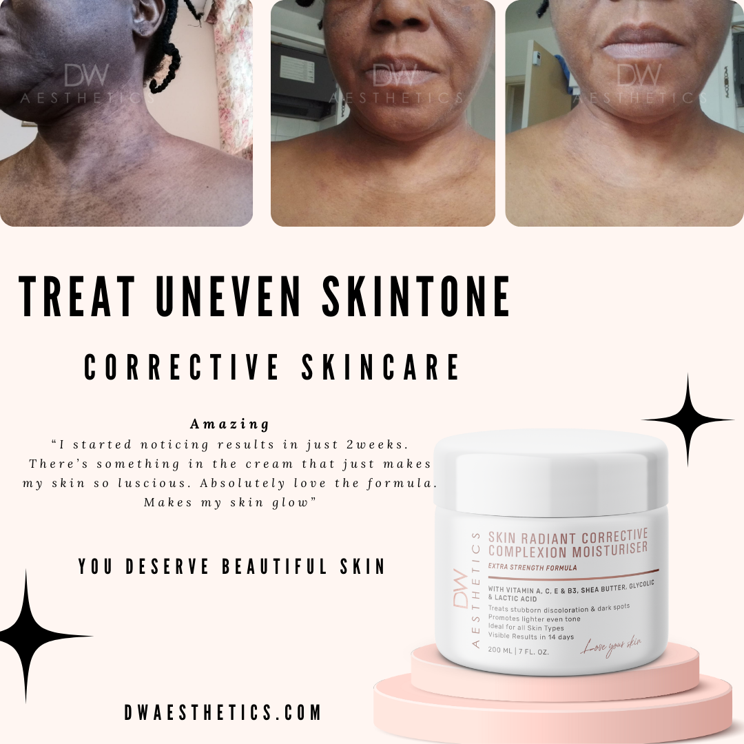 skin lightening, brightening serums, skin care aesthetics | DW Aesthetics